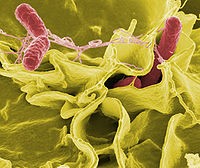 Kolibakteriozę wywołują patogenne serotypy E. coli. 