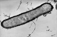 Zgnilec złośliwy (zgnilec amerykański)